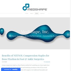 Benefits of NiTiNOL Compression Staples for Bone Fixation in Foot & Ankle Surgeries