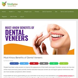 Must-Know Benefits of Dental Veneers