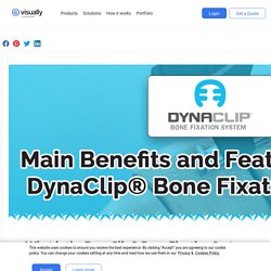Main Benefits and Features of DynaClip® Bone Fixation System