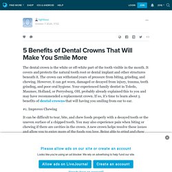 5 Benefits of Dental Crowns That Will Make You Smile More