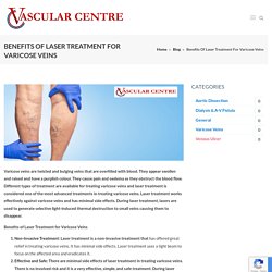 Benefits of Laser Treatment for Varicose Veins