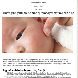 Hướng xử lý khi trẻ sơ sinh bị rôm sảy ở mặt mẹ cần biết - biohoneybabybalm.simplesite.com