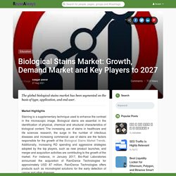 Biological Stains Market: Growth, Demand Market and Key Players to 2027