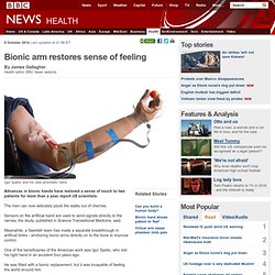 Bionic arm restores sense of feeling