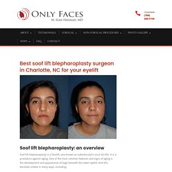 Soof lift blepharoplasty– the lower eyelid facelift from the top surgeon