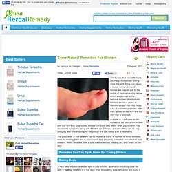 How To Treat Blisters Naturally - Home Remedies For Blisters