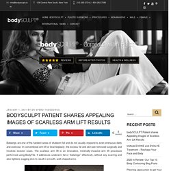 bodySCULPT Patient shares Appealing Images of Scarless Arm Lift Results
