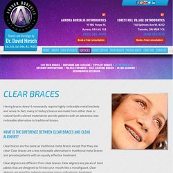 Get Smile with Clear Braces Toronto & Forest Hill Ontario