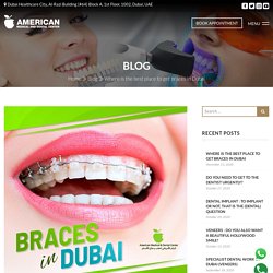 Where is the best place to get braces in Dubai