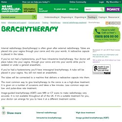 Brachytherapy - Information and support