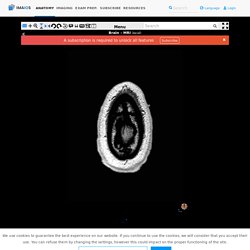 Brain: Atlas of human anatomy with MRI