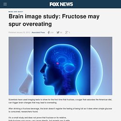Brain image study: Fructose may spur overeating