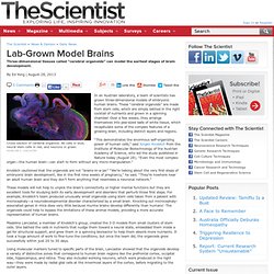 Lab-Grown Model Brains