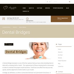 Tooth Bridges at Affordable Cost