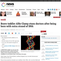 Brave toddler Alfie Clamp stuns doctors after being born with extra strand of DNA