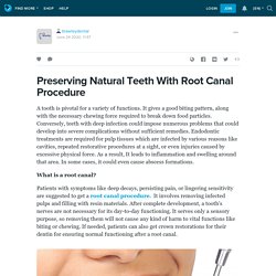 Preserving Natural Teeth With Root Canal Procedure