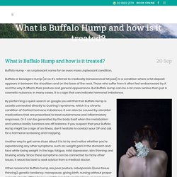 What is Buffalo Hump and how is it treated?