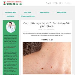 Cách chữa mụn thịt dư ở cổ, chân tay đơn giản tại nhà