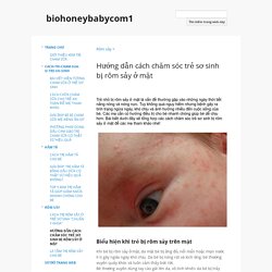 Hướng dẫn cách chăm sóc trẻ sơ sinh bị rôm sảy ở mặt - biohoneybabycom1