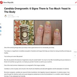 Candida Overgrowth: 6 Signs There Is Too Much Yeast In The Body