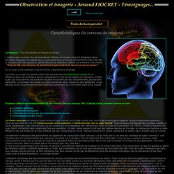 Caractéristiques du cerveau du surdoué - ETRE SURDOUE - PRECOCITE ET DOUANCE : Un handicap plutôt qu'une chance !