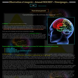 Caractéristiques du cerveau du surdoué - ETRE SURDOUE - PRECOCITE ET DOUANCE : Un handicap plutôt qu'une chance !