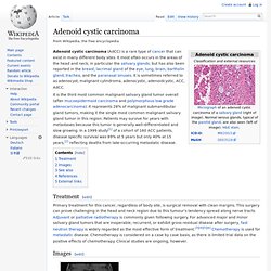 Adenoid cystic carcinoma