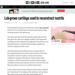 Lab-grown cartilage used to reconstruct nostrils