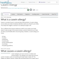 Casein Allergy Information