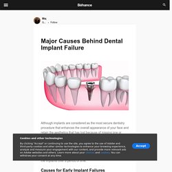 Major Causes Behind Dental Implant Failure on Behance