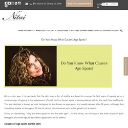 Do You Know What Causes Age Spots? - Nitai medical and cosmetic centre