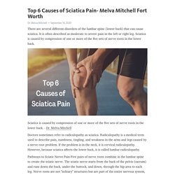 Top 6 Causes of Sciatica Pain- Melva Mitchell Fort Worth