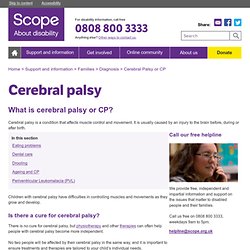 Introduction to cerebral palsy - What is cerebral palsy? - Causes of cerebral palsy - Types of cerebral palsy - Disability Charity - Scope UK
