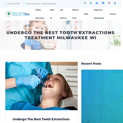Tooth Extraction Milwaukee