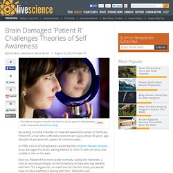 Brain Damaged ‘Patient R’ Challenges Theories of Self Awareness