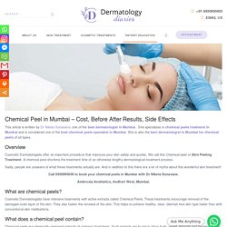 Chemical Peels in Mumbai - Cost, Before After Results, Side Effects