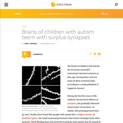 Brains of children with autism teem with surplus synapses