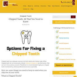 Chipped Tooth: All That You Need to Know