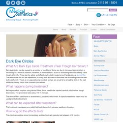 Treatment for Dark Eye Circles