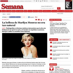 Cirugías de Marilyn Monroe, Gente