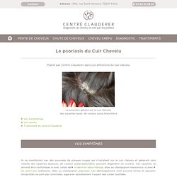 Psoriasis du Cuir Chevelu