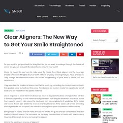 Clear Aligners: The New Way to Get Your Smile Straightened