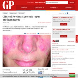 Clinical Review: Systemic lupus erythematosus