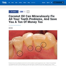 Coconut Oil Can Miraculously Fix All Your Teeth Problems, And Save You A Ton Of Money Too