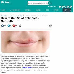 Cold Sores: How to Get Rid of Cold Sores Naturally