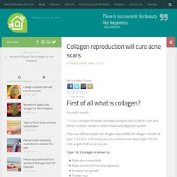 Collagen reproduction will cure acne scars – Remedy for Acne