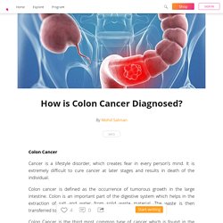 How is Colon Cancer Diagnosed?