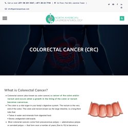 COLORECTAL CANCER (CRC) – GastroEntrology
