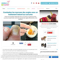 Combattez les mycoses des ongles avec un traitement naturel au curcuma - Améliore ta Santé