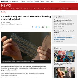 Complete vaginal-mesh removals 'leaving material behind'
